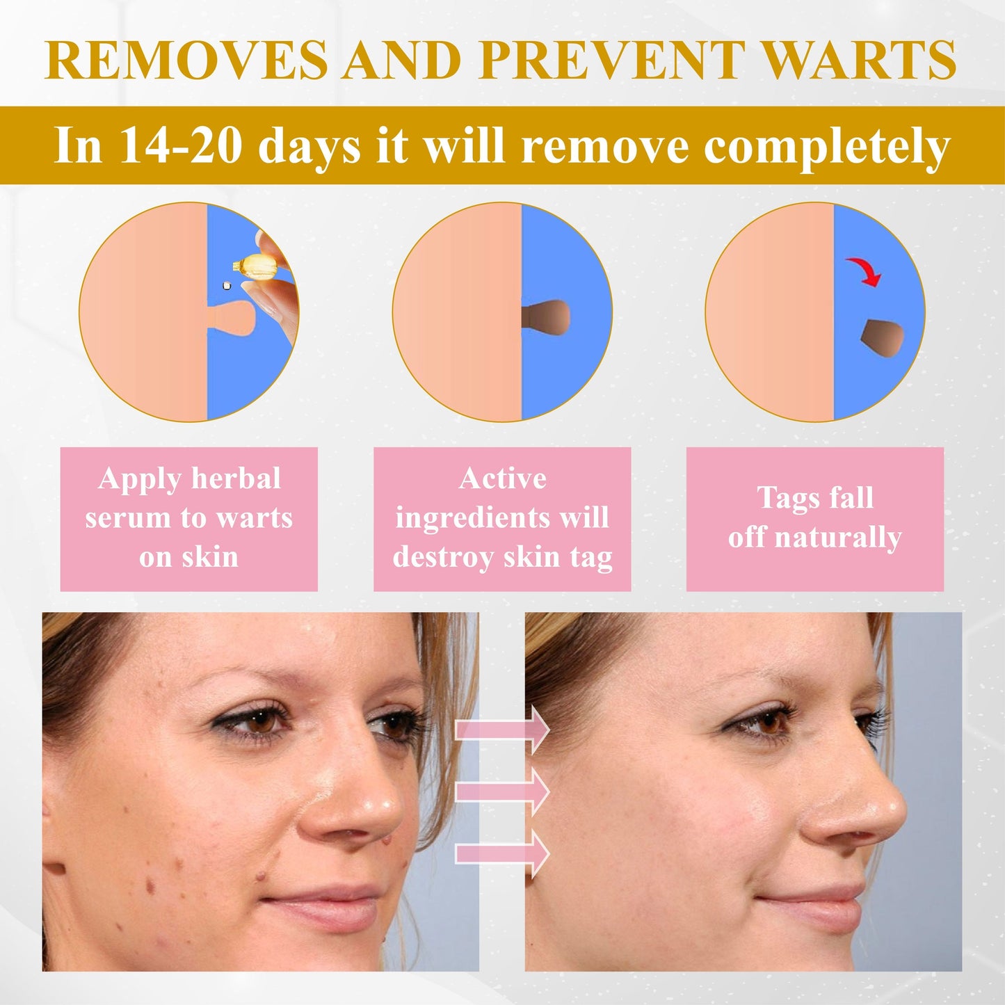 ATTDX® Advanced Fig Tag & Mole Off Capsule Serum