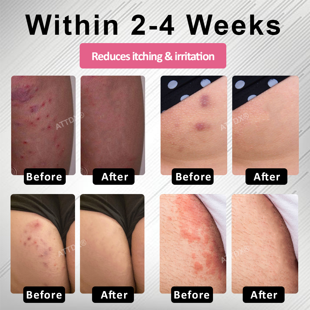 ATTDX® AgNPs Feminine Intimate Care Spray