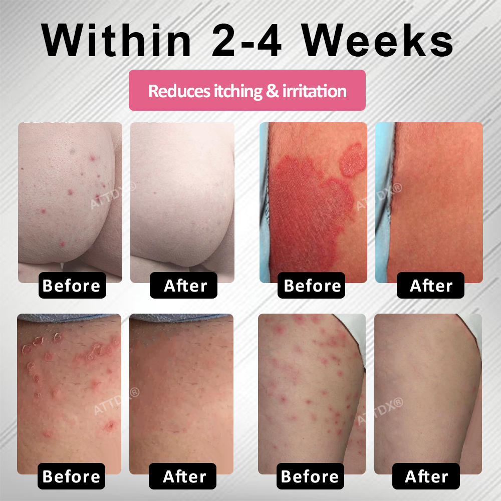 ATTDX® AgNPs Feminine Intimate Care Spray