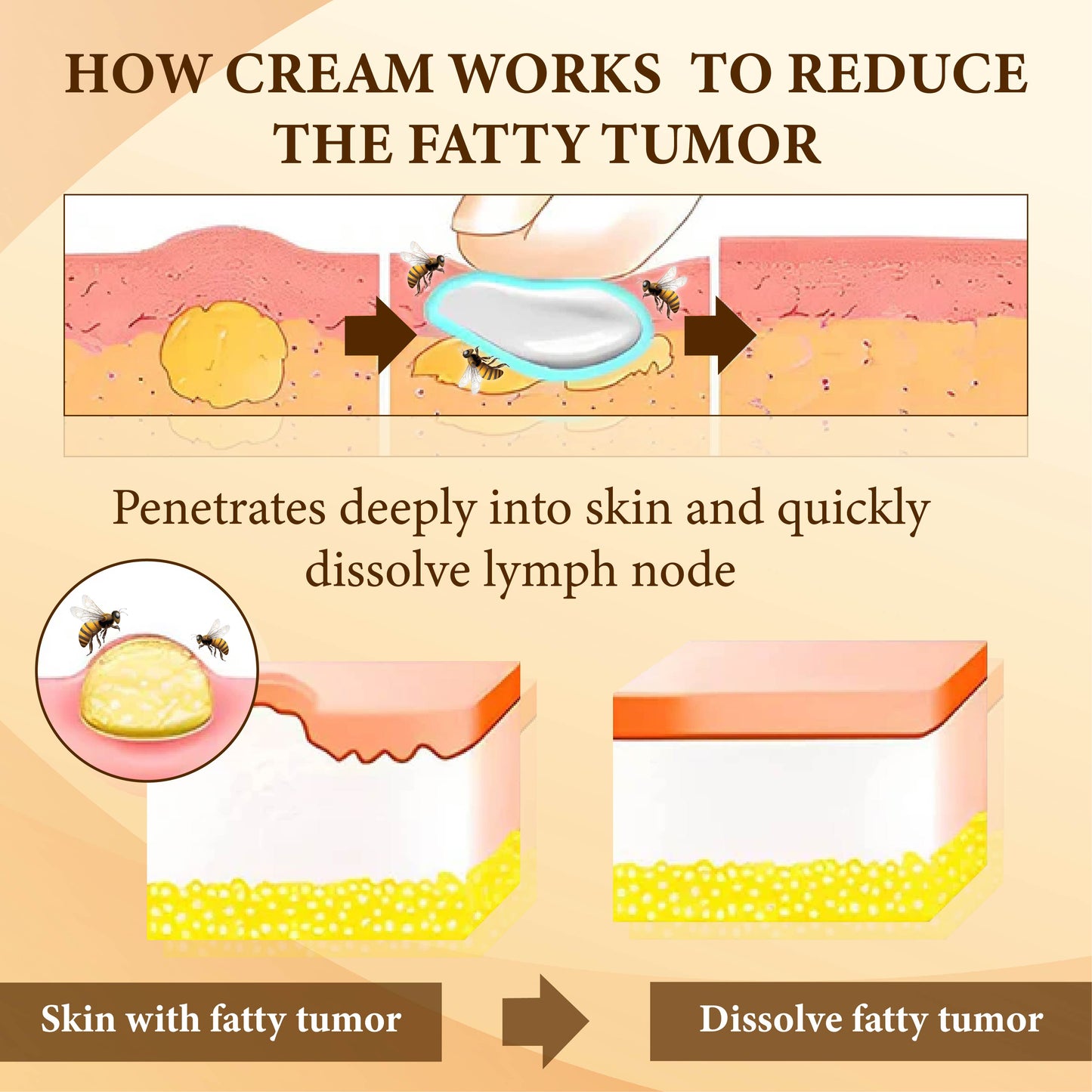 Bee Venom FatLumps LymphaticRecovery Cream