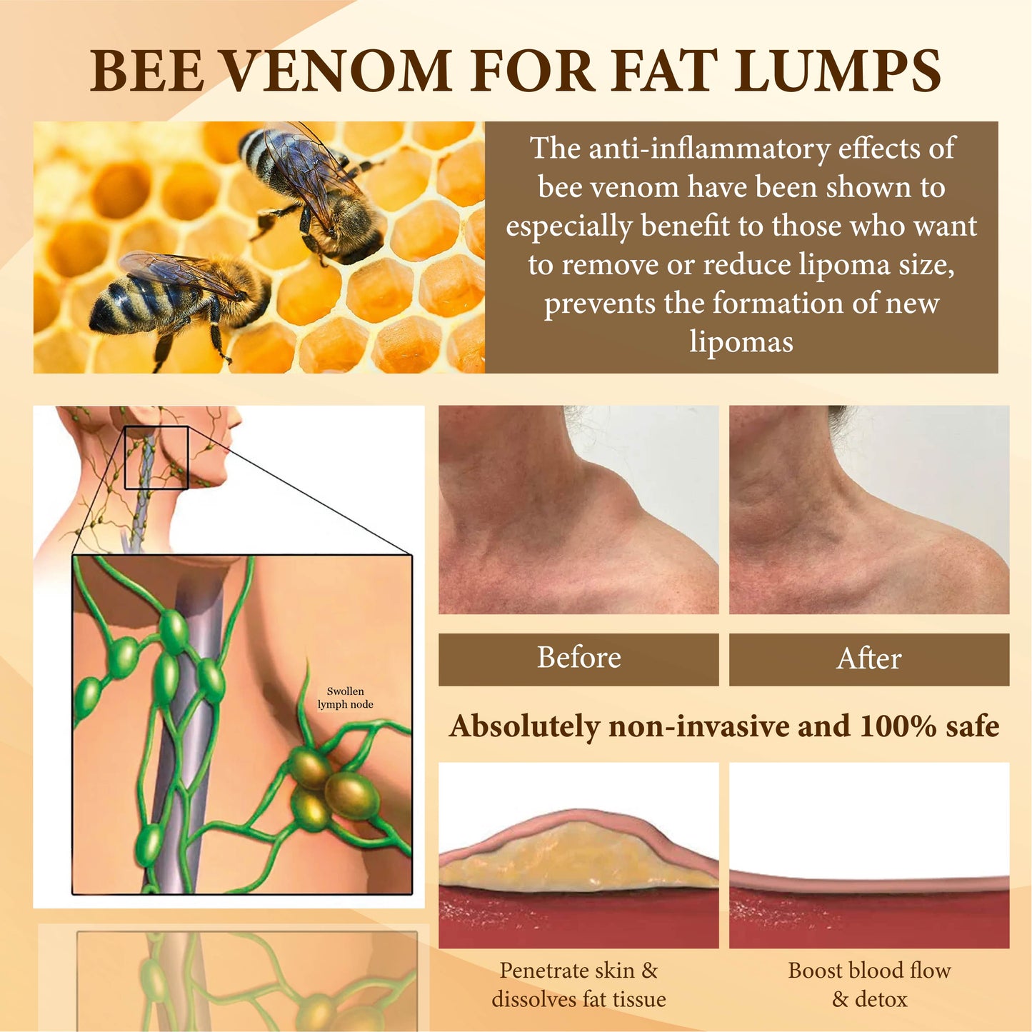 Bee Venom FatLumps LymphaticRecovery Cream