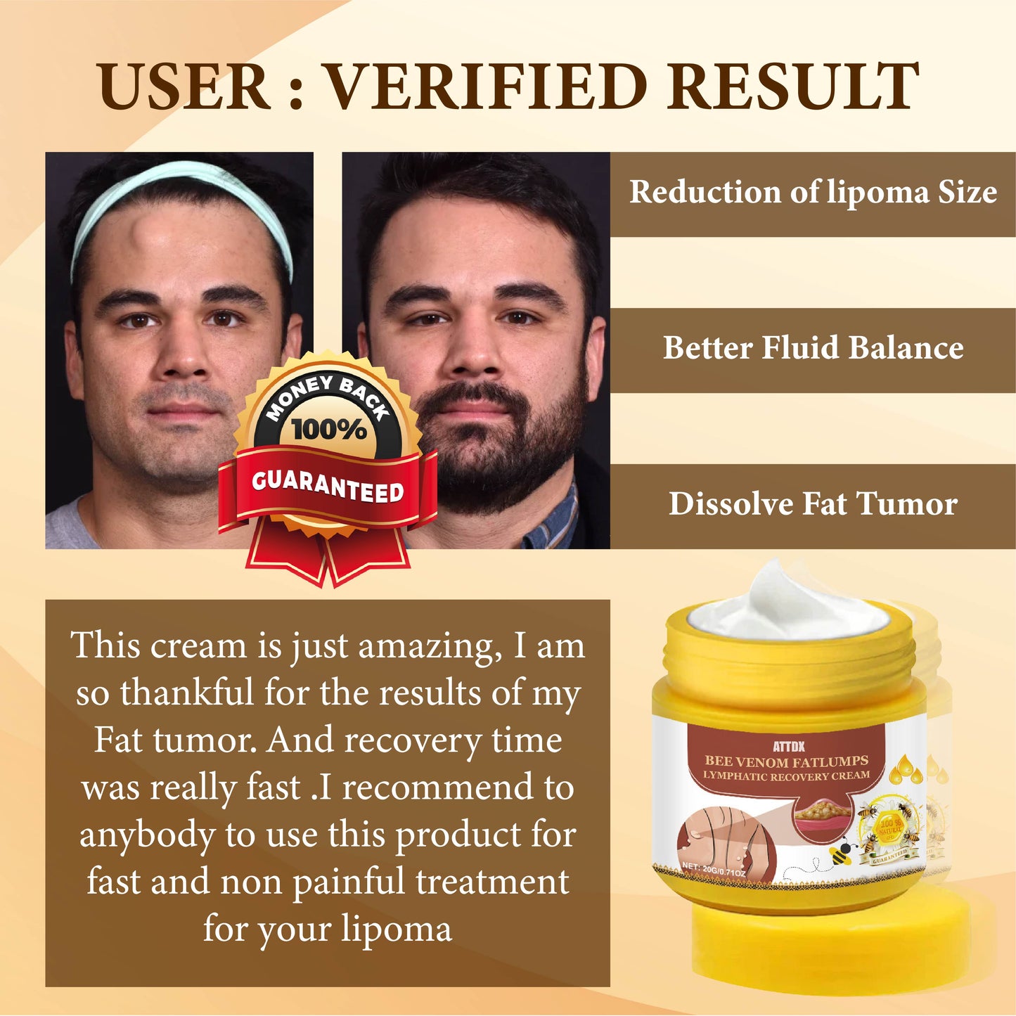 Bee Venom FatLumps LymphaticRecovery Cream