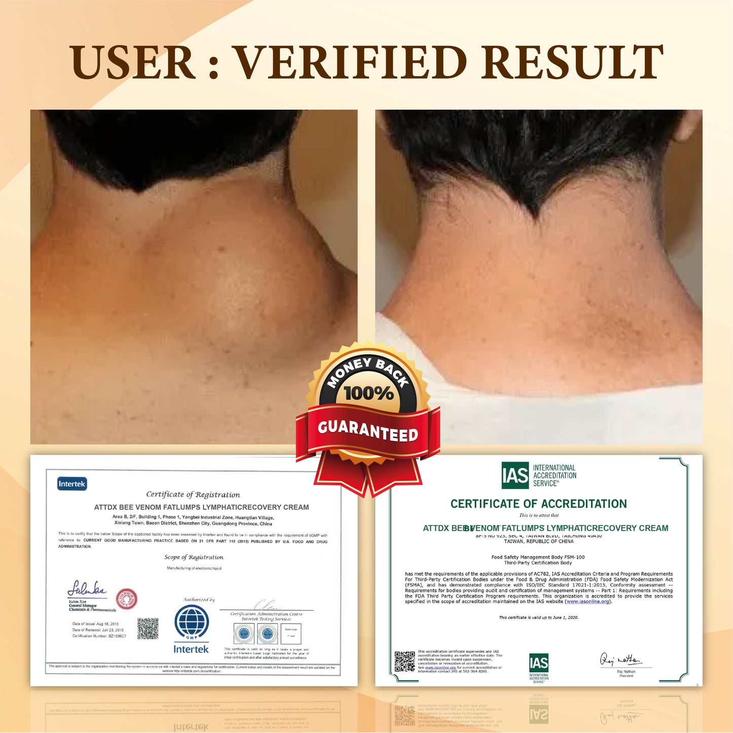 Bee Venom FatLumps LymphaticRecovery Cream
