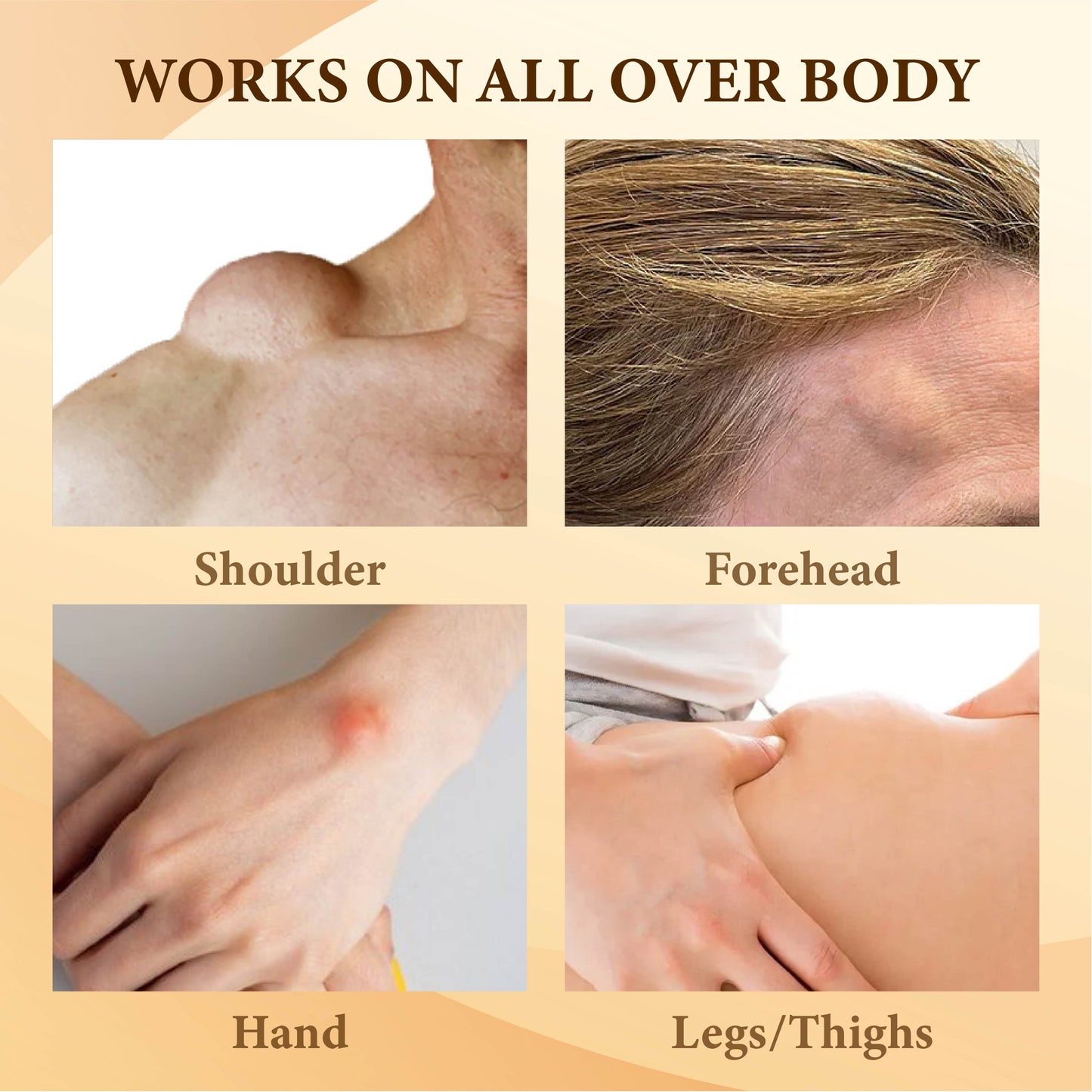 Bee Venom FatLumps LymphaticRecovery Cream