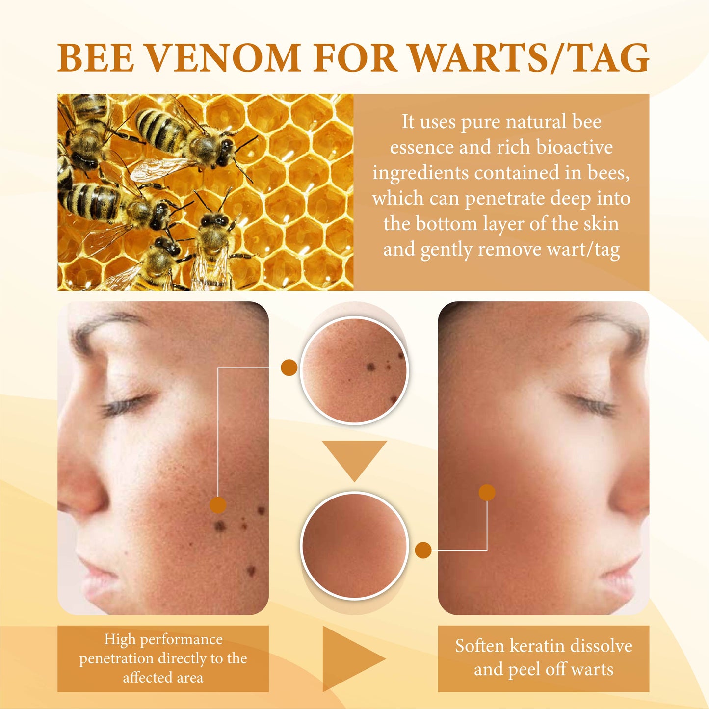 Bee Venom WartsNTag SmoothClear Remover