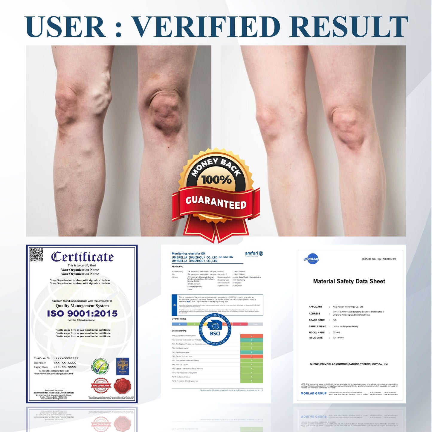 ATTDX® Black Cumin Edema Soothing Herbal Cream -👩⚕️Doctor-Endorsed Herbal Formula