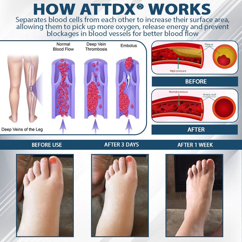 ATTDX® Black Cumin Edema Soothing Herbal Cream -👩⚕️Doctor-Endorsed Herbal Formula