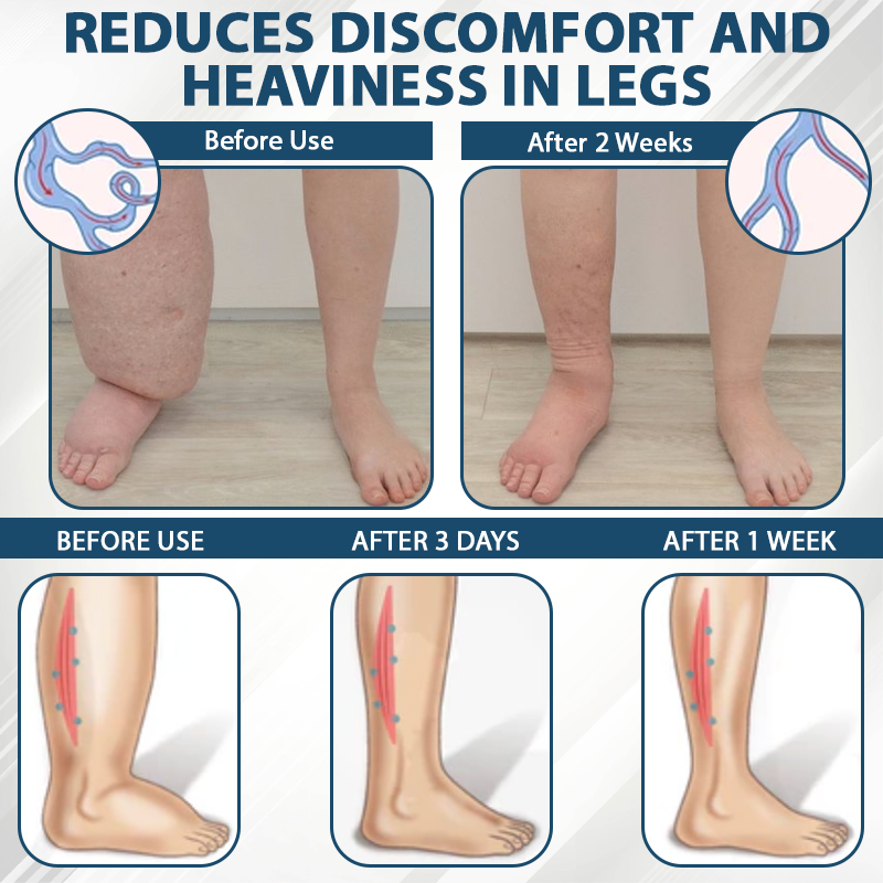 ATTDX® Black Cumin Edema Soothing Herbal Cream -👩⚕️Doctor-Endorsed Herbal Formula