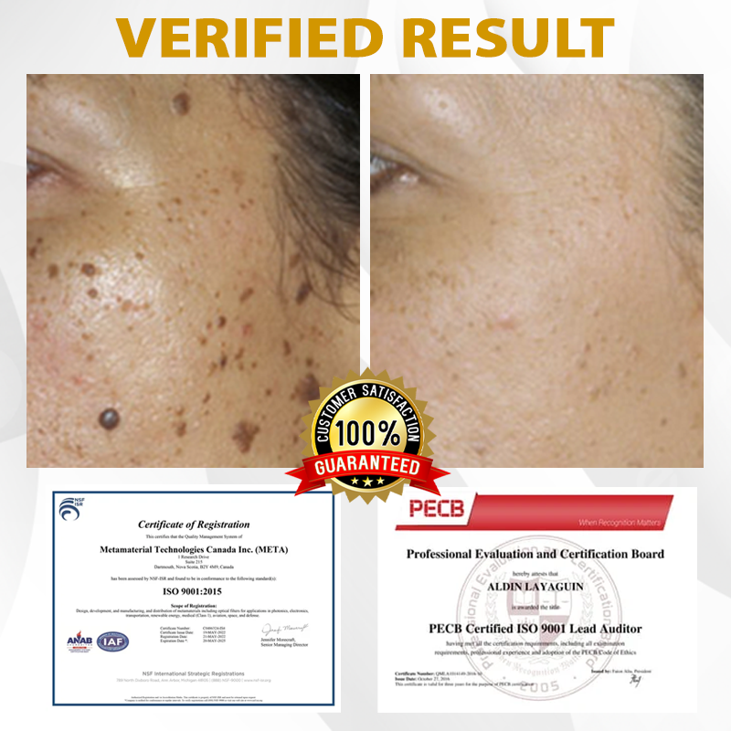 ATTDX® CastorBee Tag & Spots Peel-Off Mask