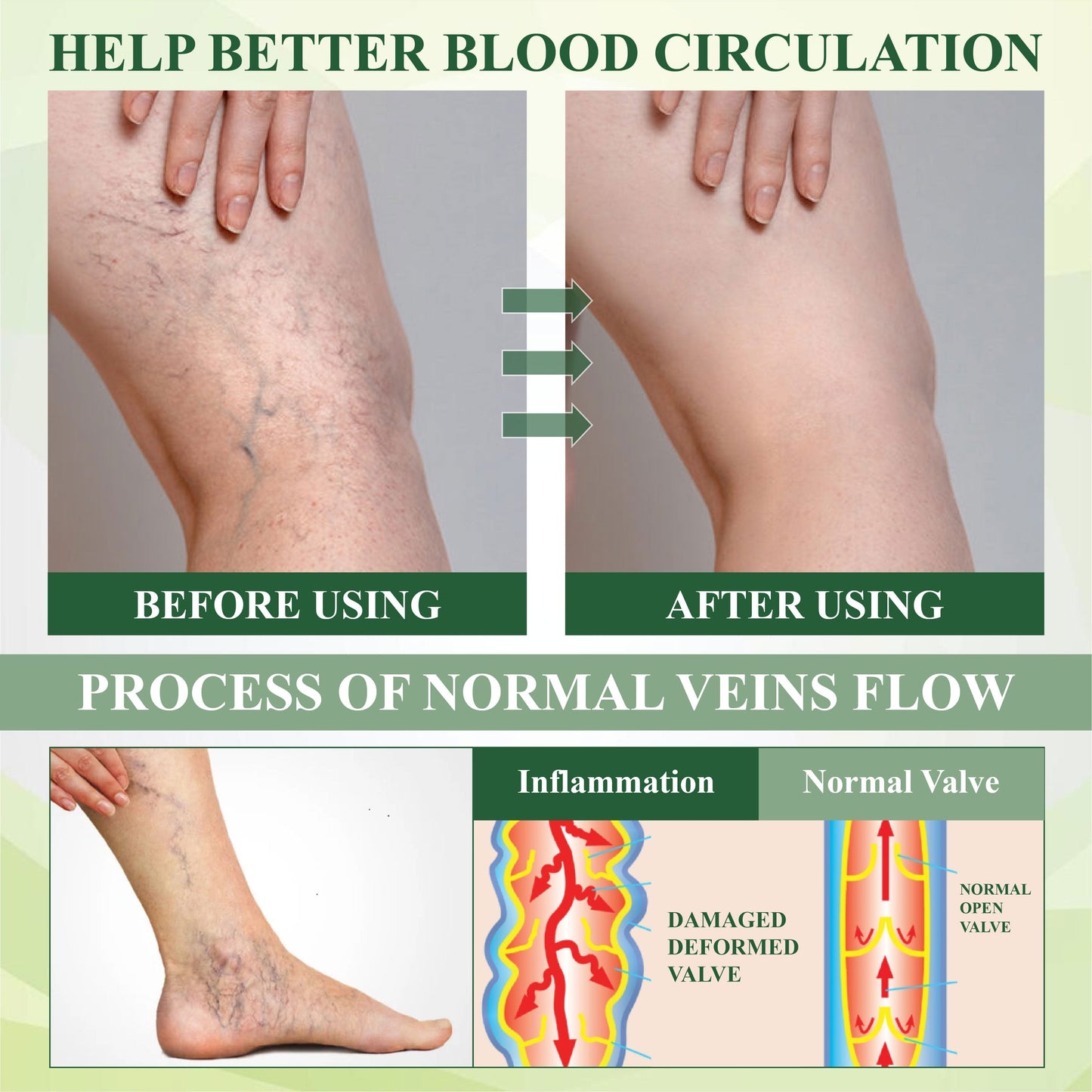 ATTDX® CircuHerb Edema Soothing & Healing Balm 2
