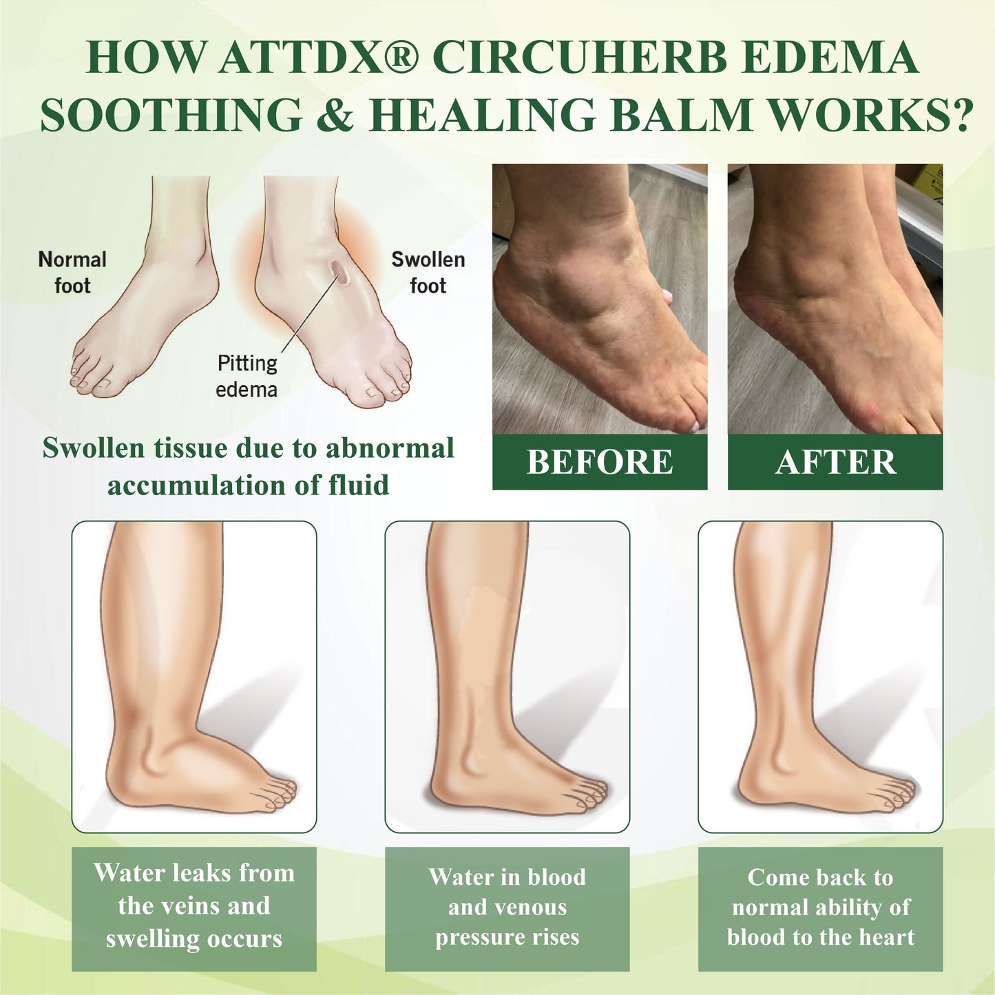 ATTDX® CircuHerb Edema Soothing & Healing Balm 2