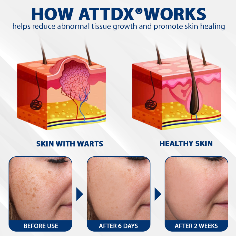 ATTDX® DermaSoft Tag & Mole Clear Gel
