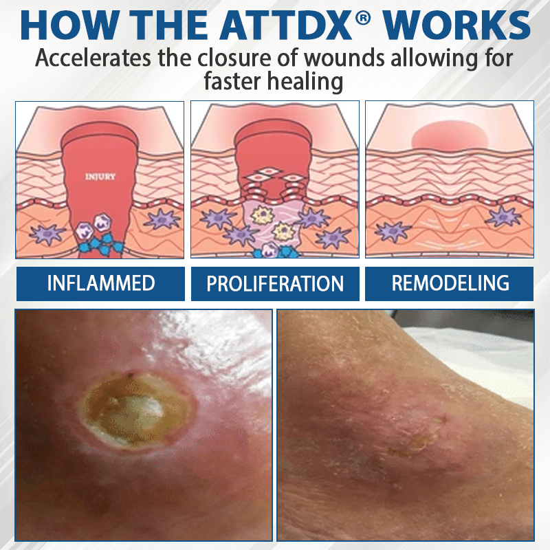 ATTDX® Diabetes Foot Guard Fast Recovery Spray