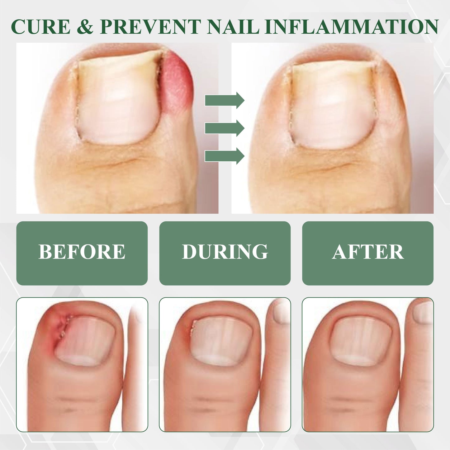 ATTDX® FungaGuard Nail Renewal Herbal Spray