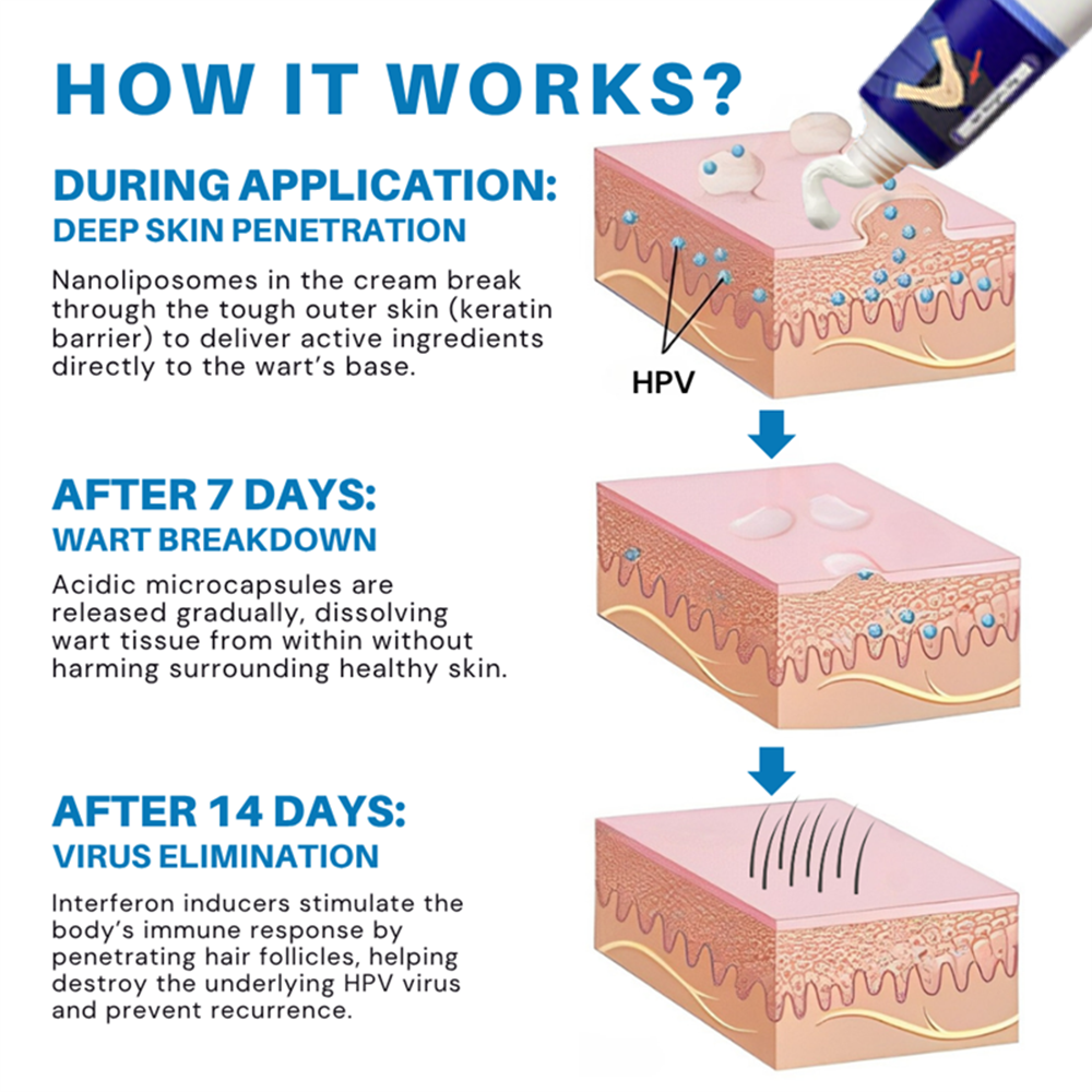 ATTDX® HPV Genital Warts Relief Cream