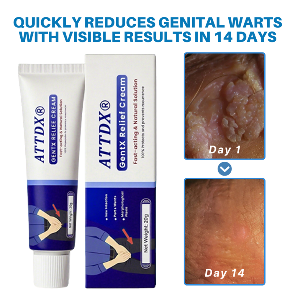 ATTDX® HPV Genital Warts Relief Cream