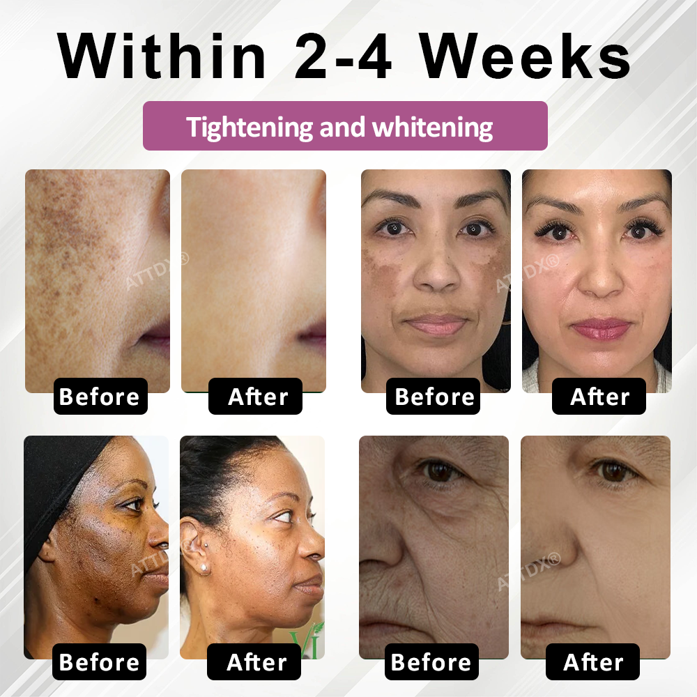 ATTDX® Korean SkinRewind Spot & Wrinkles Toner Pads