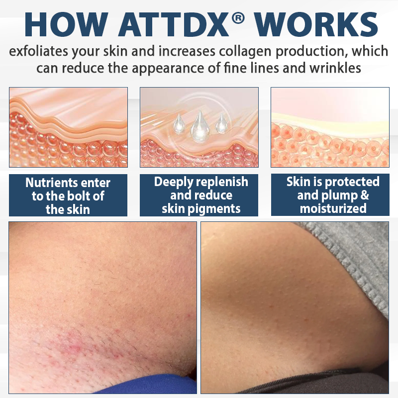 ATTDX® LicorRelief Man Genital Antifungal Cream