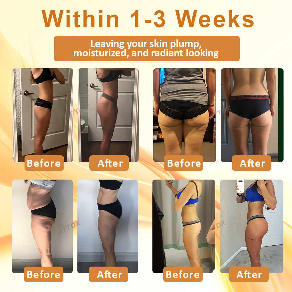 ATTDX™ Micro Crystals ButtLifting Patch