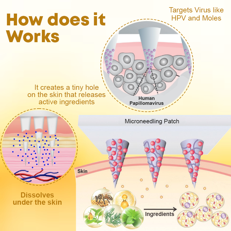 MoleClear Microneedle BeeVenom Patch