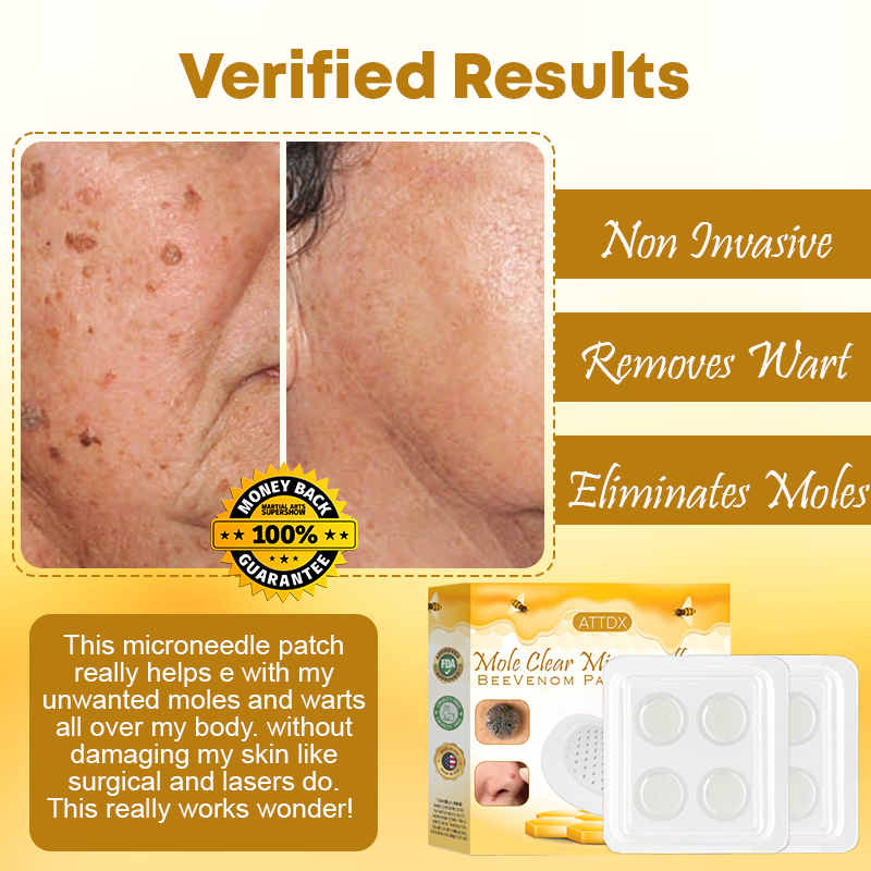 MoleClear Microneedle BeeVenom Patch