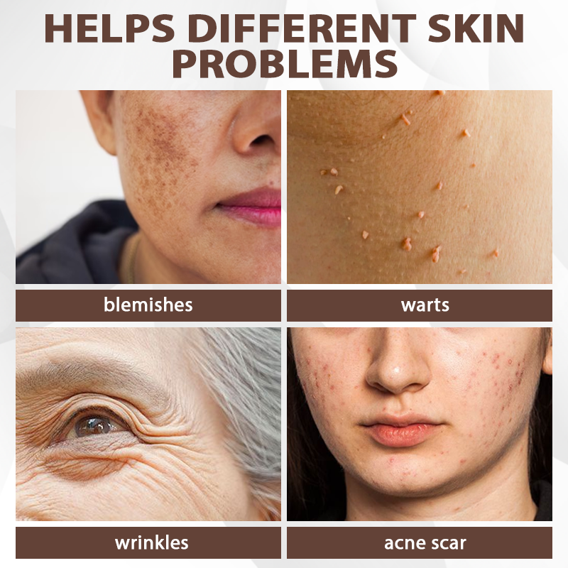 ATTDX® MulberryFade Spot & Wrinkles Peel-Off Mask