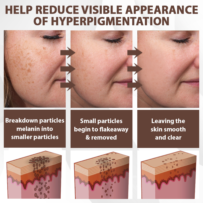 ATTDX® MulberryFade Spot & Wrinkles Peel-Off Mask
