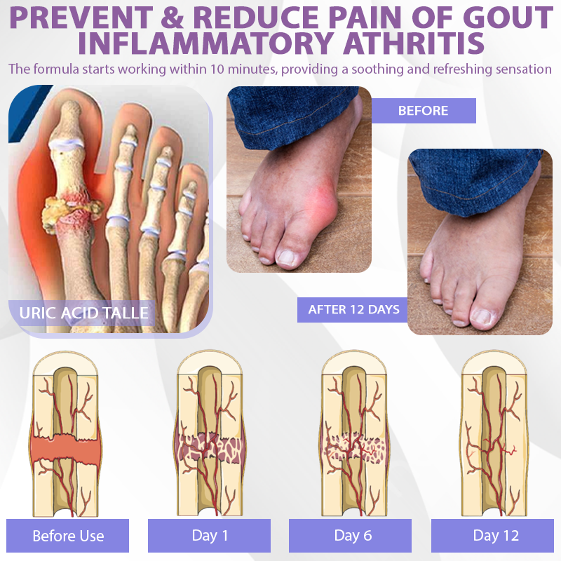 ATTDX® Purple Corn Joint Targeted Relief Gel