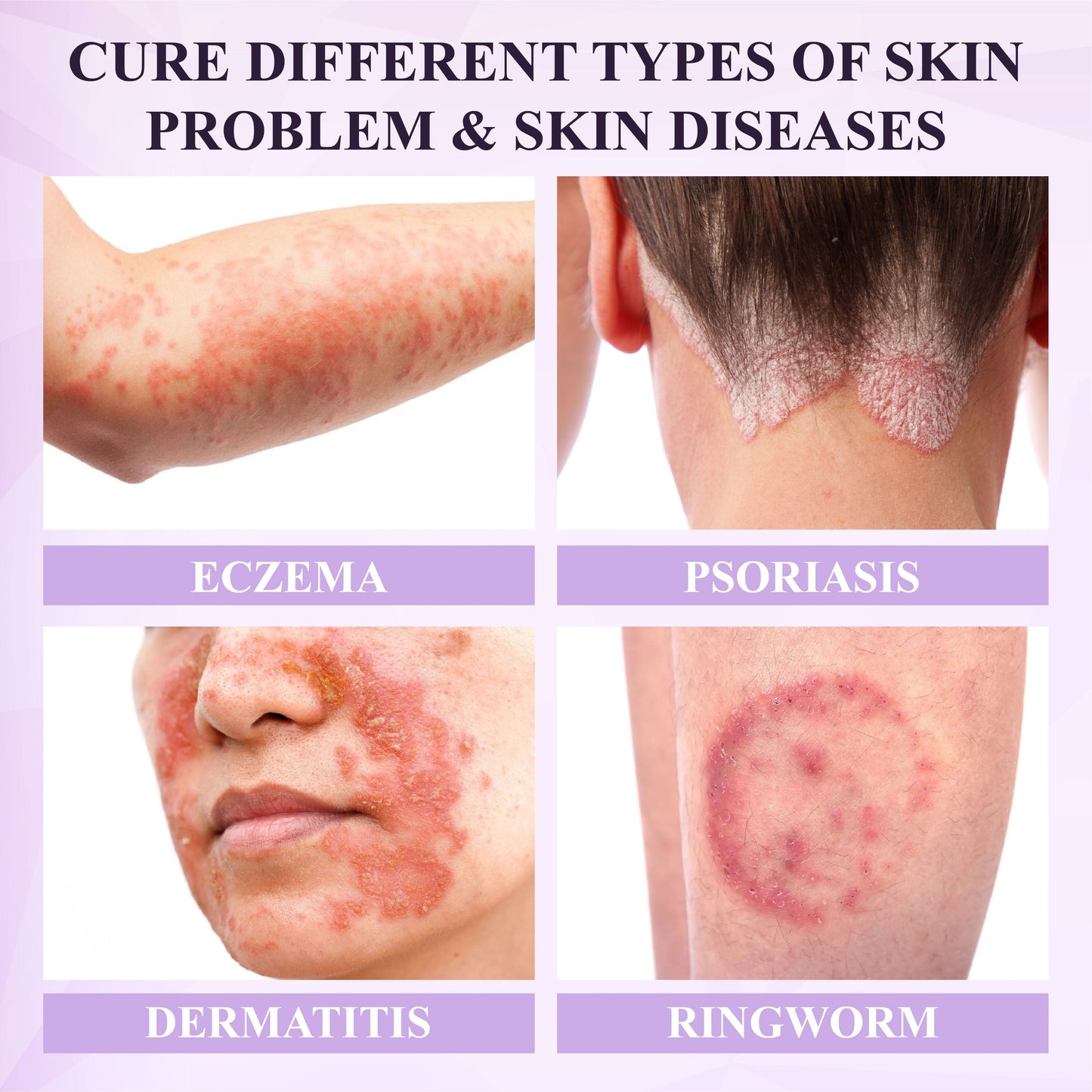 ATTDX® Purple Corn Multi-Condition Skin Spray