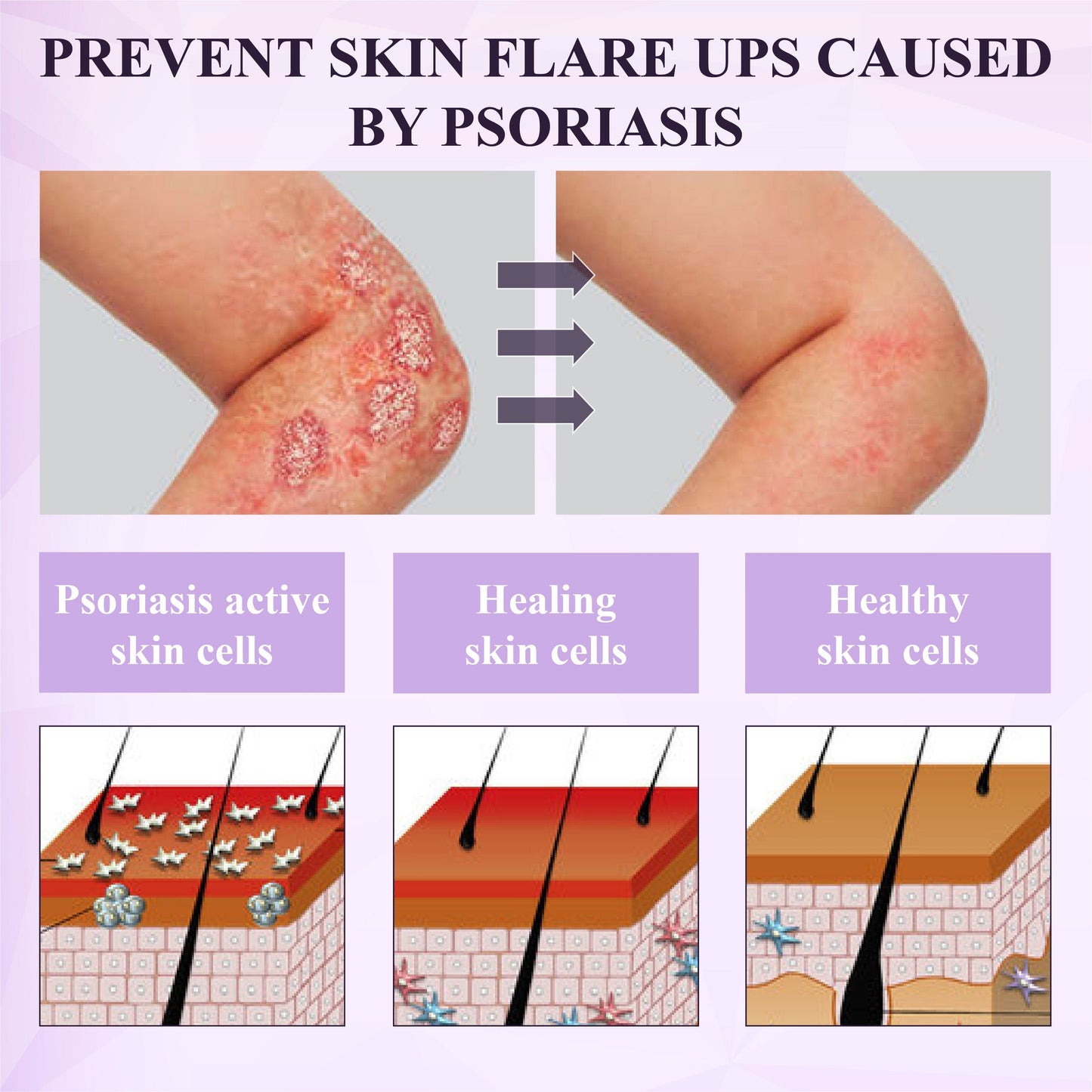 ATTDX® Purple Corn Multi-Condition Skin Spray