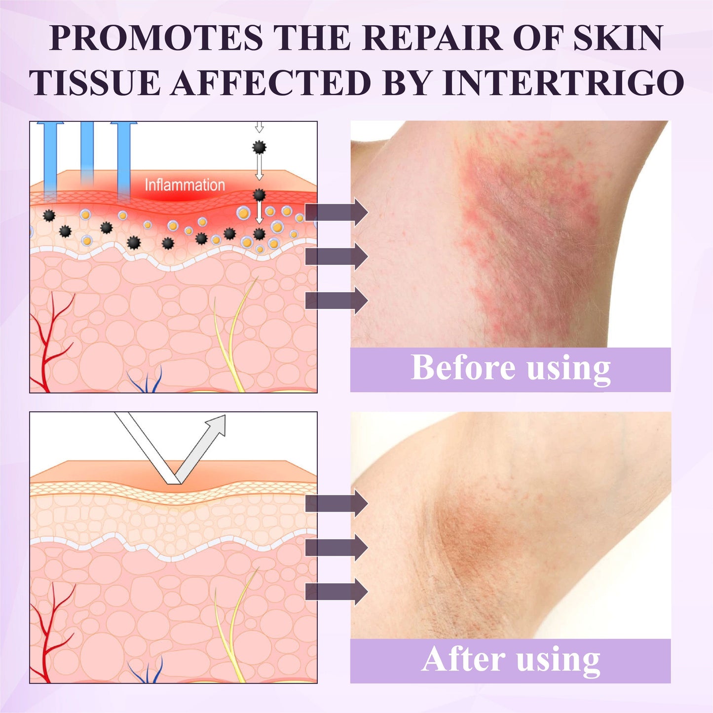 ATTDX® Purple Corn Multi-Condition Skin Spray
