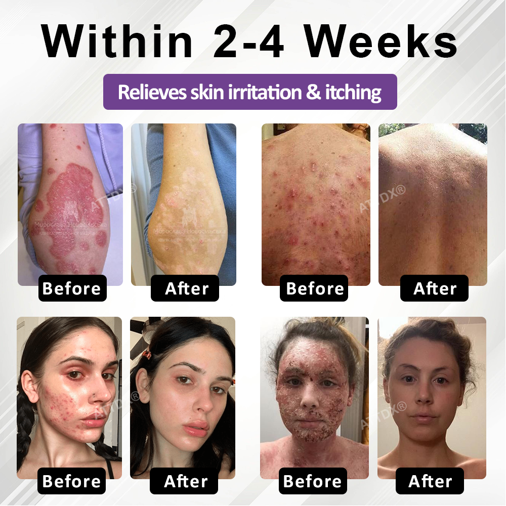 ATTDX® Purple Corn Multi-Condition Skin Spray