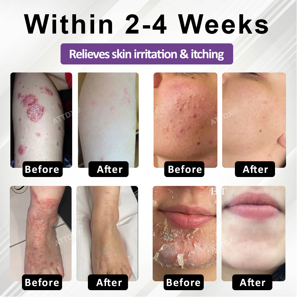 ATTDX® Purple Corn Multi-Condition Skin Spray