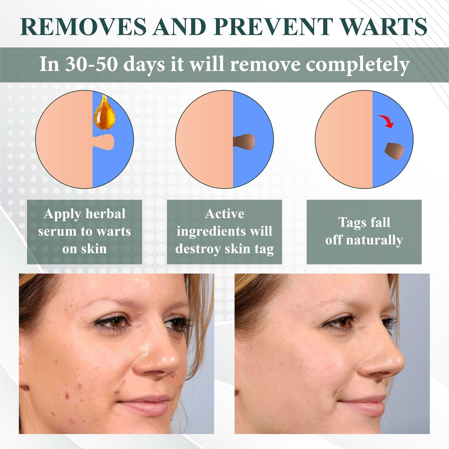 ATTDX® Reedle Shot 100 Tag & Spot Target Advanced Serum