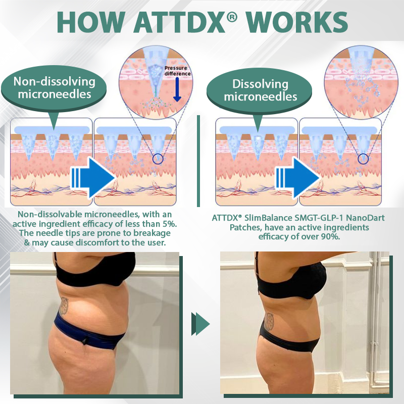 ATTDX® SlimBalance SMGT-GLP-1 NanoDart Patches