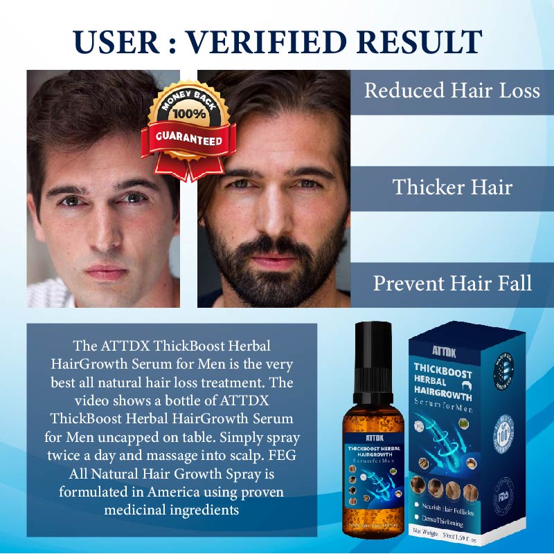 ThickBoost Herbal HairGrowth Serum for Men 2