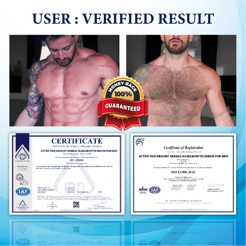 ThickBoost Herbal HairGrowth Serum for Men 2