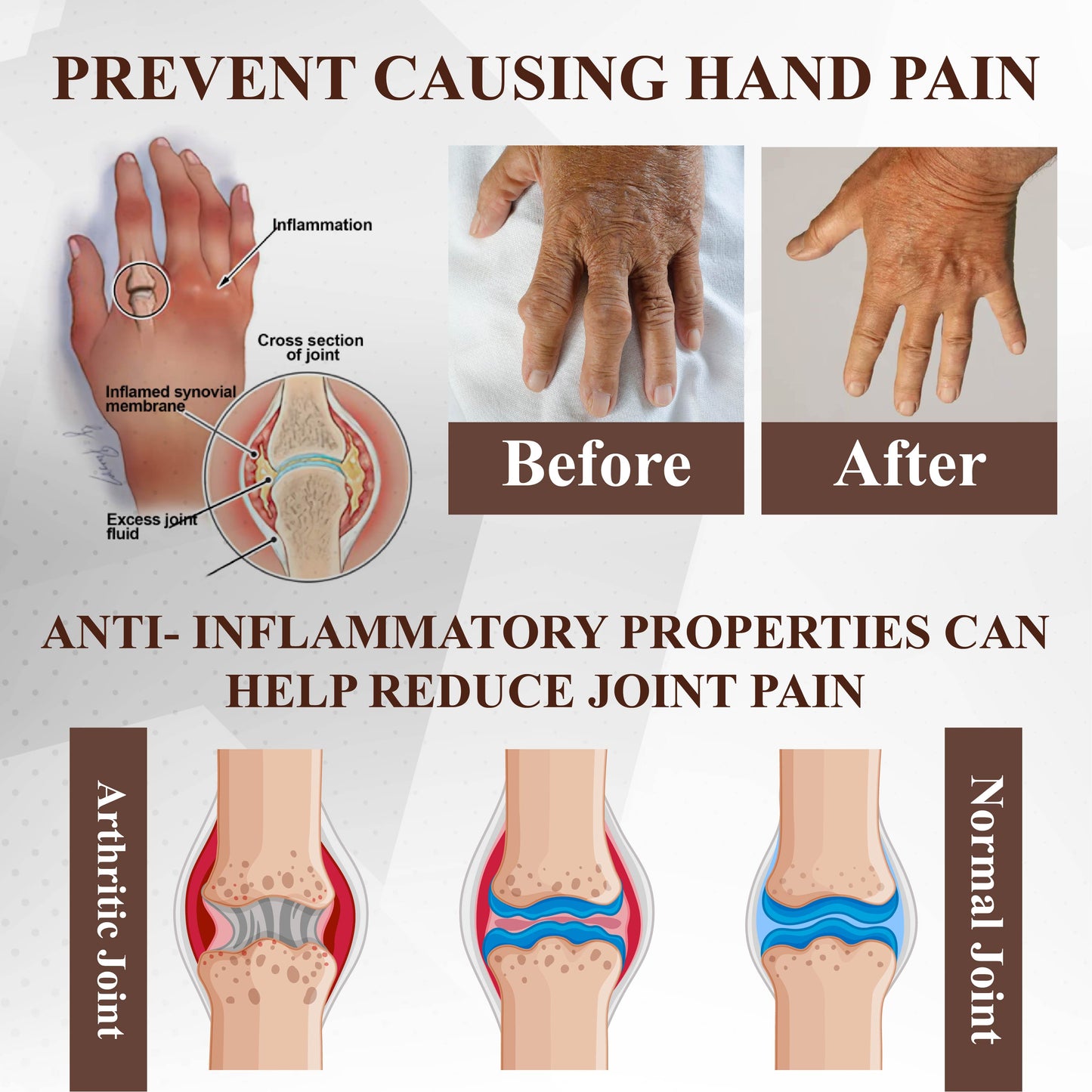 ApisRelief™ Bee and Horse Chestnut Joint Therapy Cream