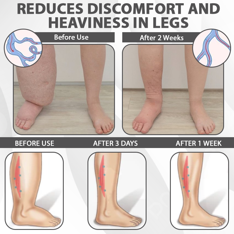 DetoxFlow™ EdemaRelief Lymphatic Detox Cream