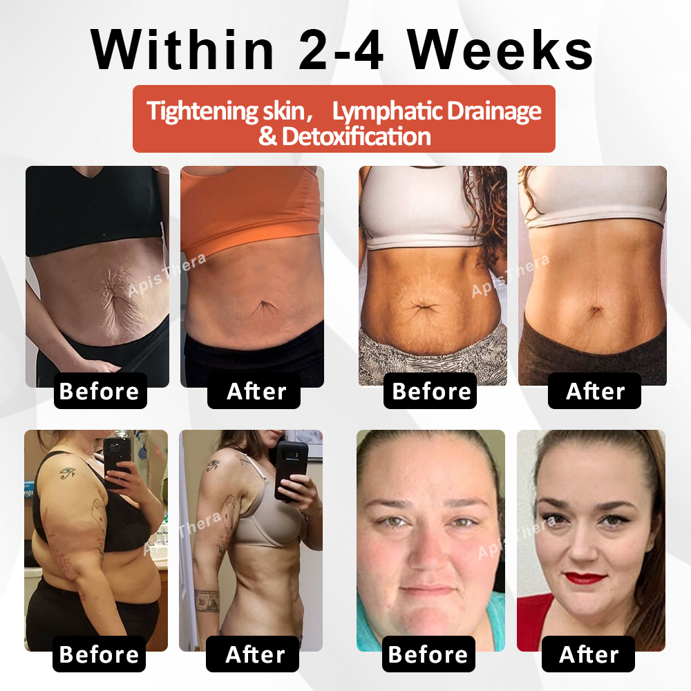 ApisThera™ LymphDetox FirmingBee Bath Beads
