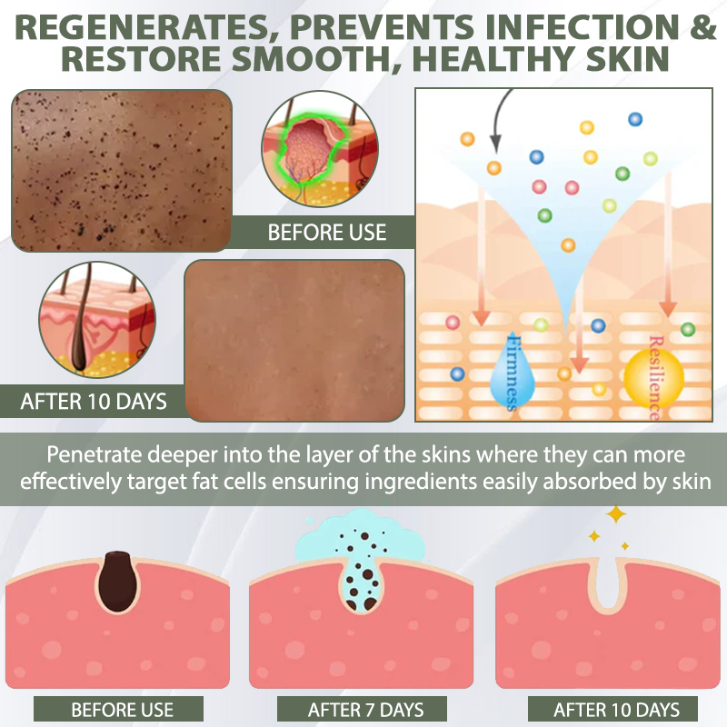 DermaEase™ Spotless Tag and WartRemoval Gel