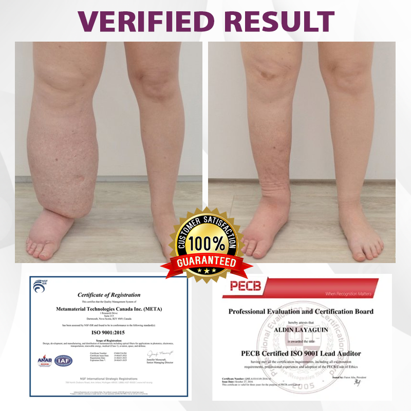 EdemaCare™ Elderberry Lymphatic Massage Cream
