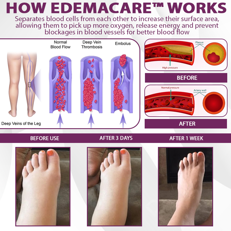 EdemaCare™ Elderberry Lymphatic Massage Cream