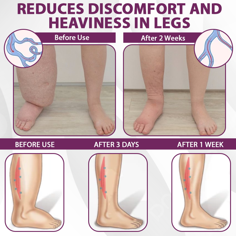 EdemaCare™ Elderberry Lymphatic Massage Cream