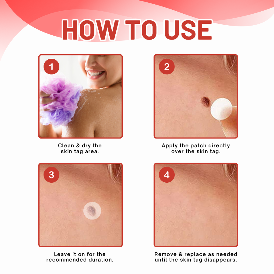 DermaEase™ MicroDart Skin Tag Remover Patch