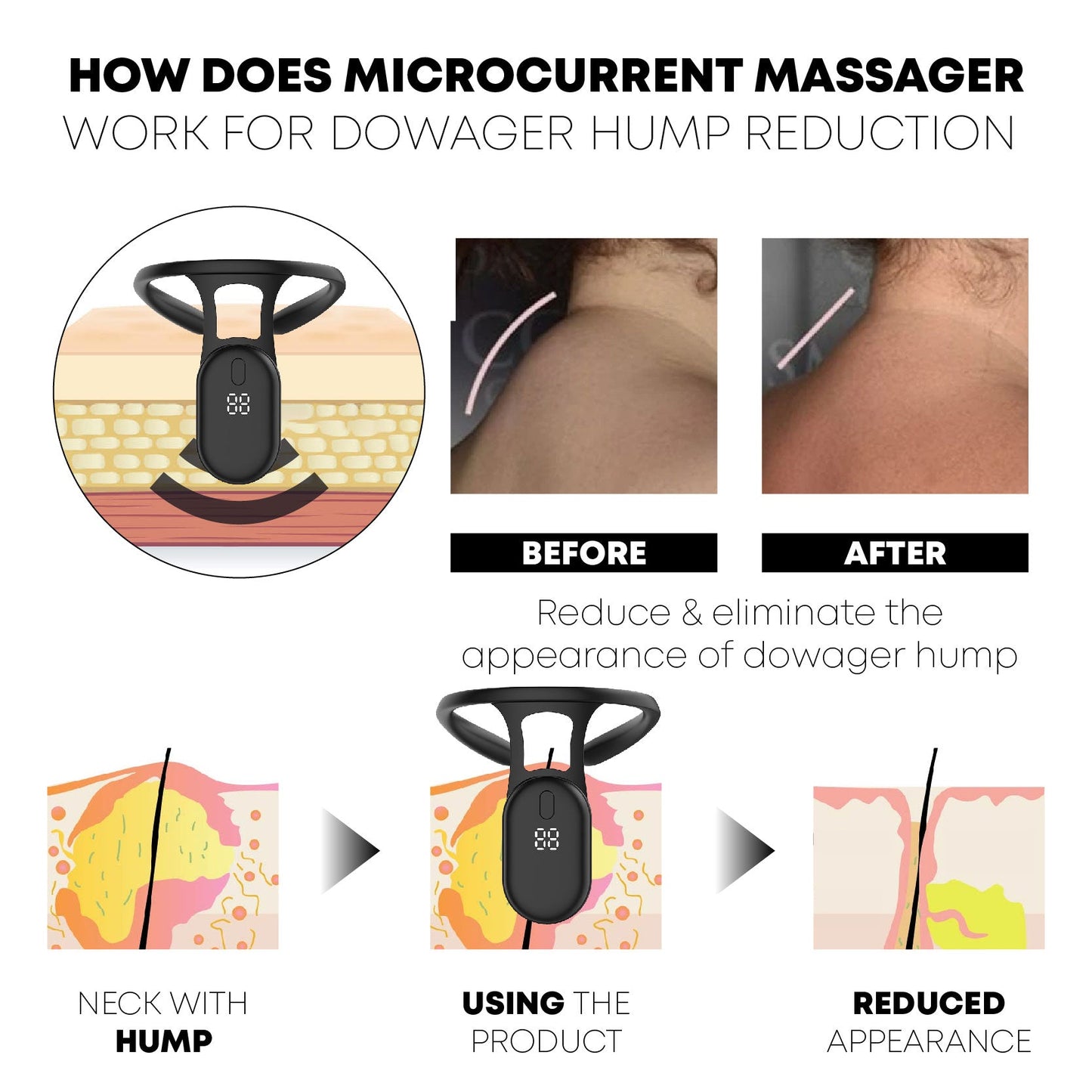 CircuWave™ Neckology Ultrasonic LymphvitySoothing Instrument