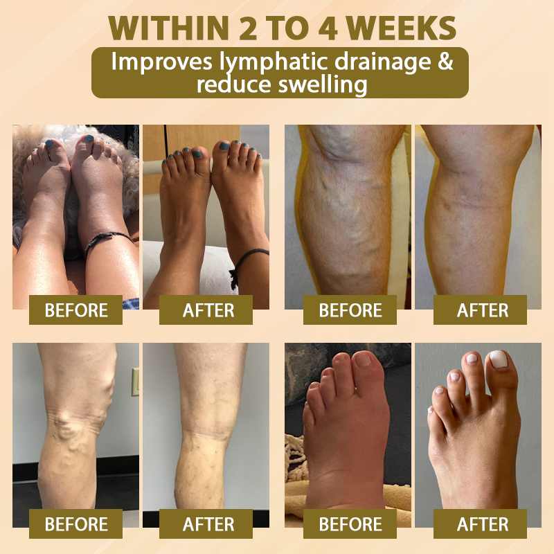 EdemaCare™ VenomDetox FirmingBody Cream