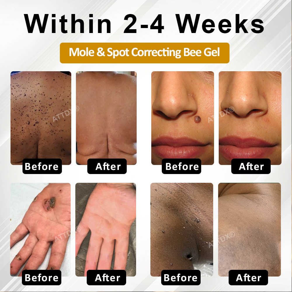 ATTDX® ClariBee Spot & Mole Corrective Cream