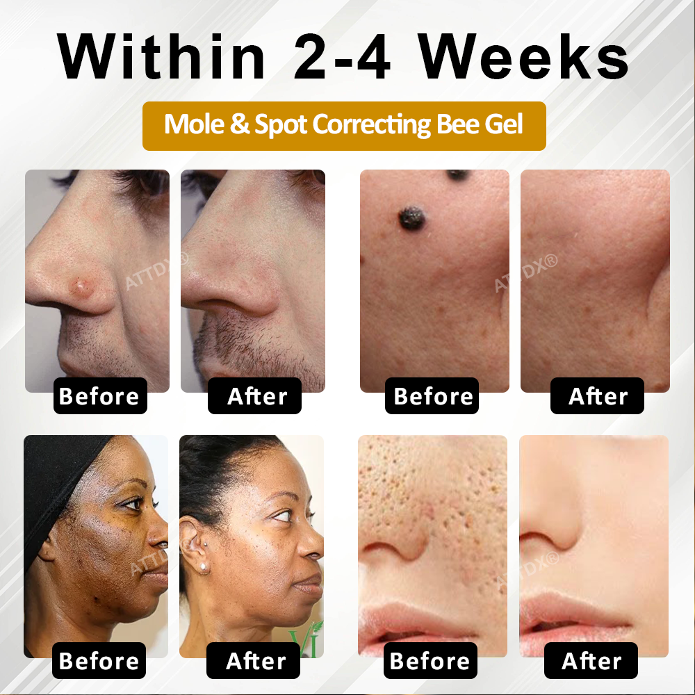ATTDX® ClariBee Spot & Mole Corrective Cream