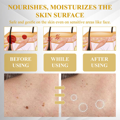 ATTDX® Advanced Fig Tag & Mole Off Capsule Serum